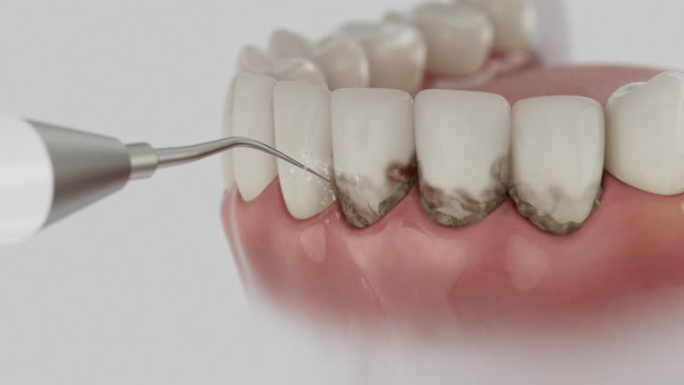 Reliable Dental contractor in Apple Valley, OH by Dentist Open Now